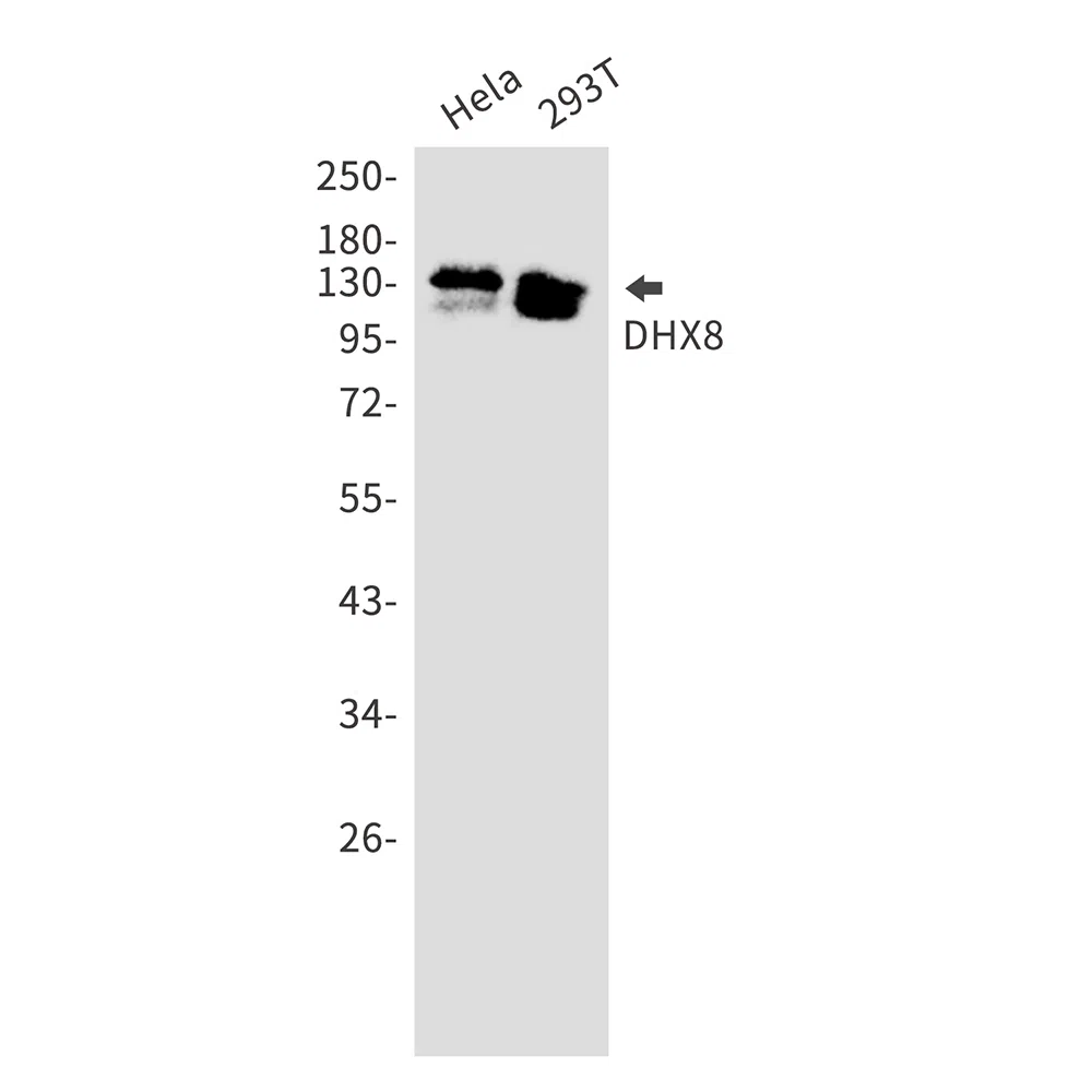 DHX8 Rabbit Monoclonal Antibody - Size: 50µl
