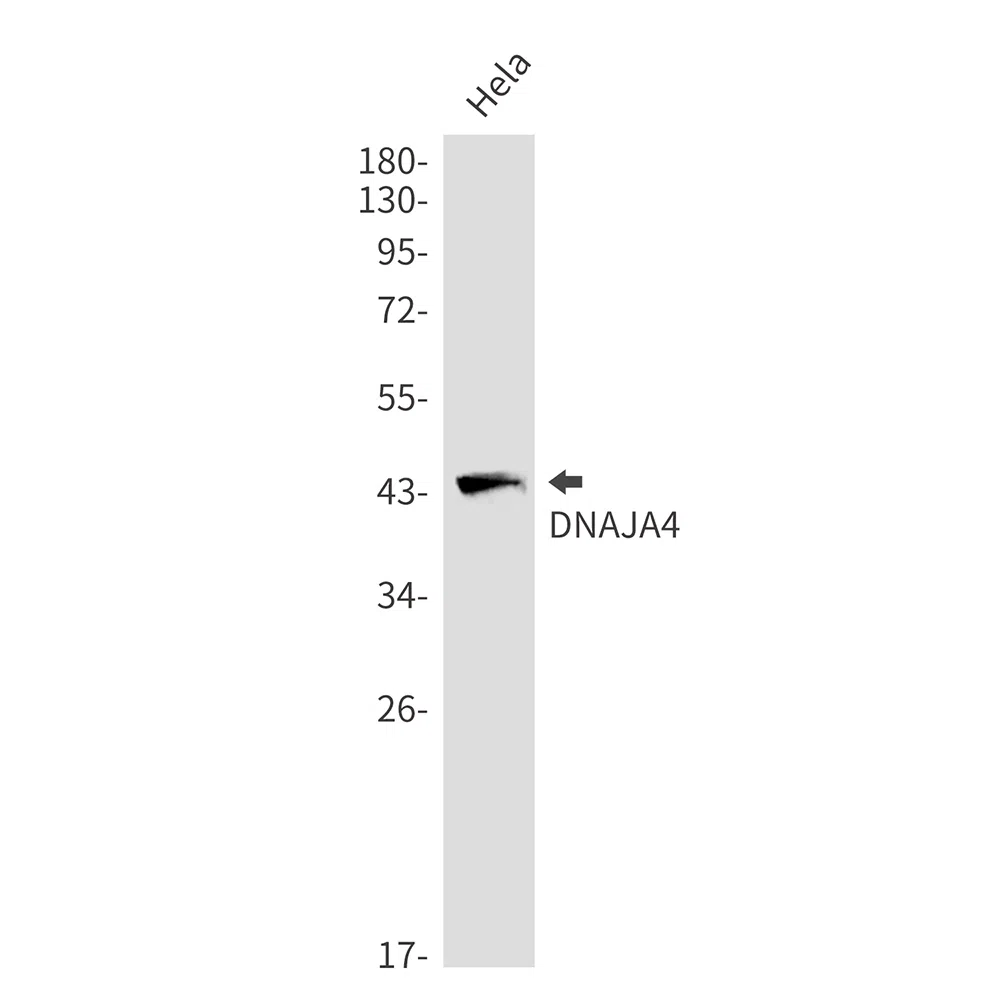 DNAJA4 Rabbit Monoclonal Antibody - Size: 100µl