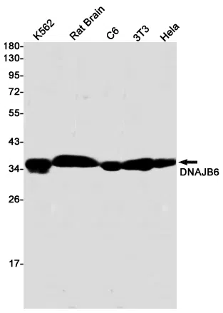 DNAJB6 Rabbit Monoclonal Antibody - Size: 50µl