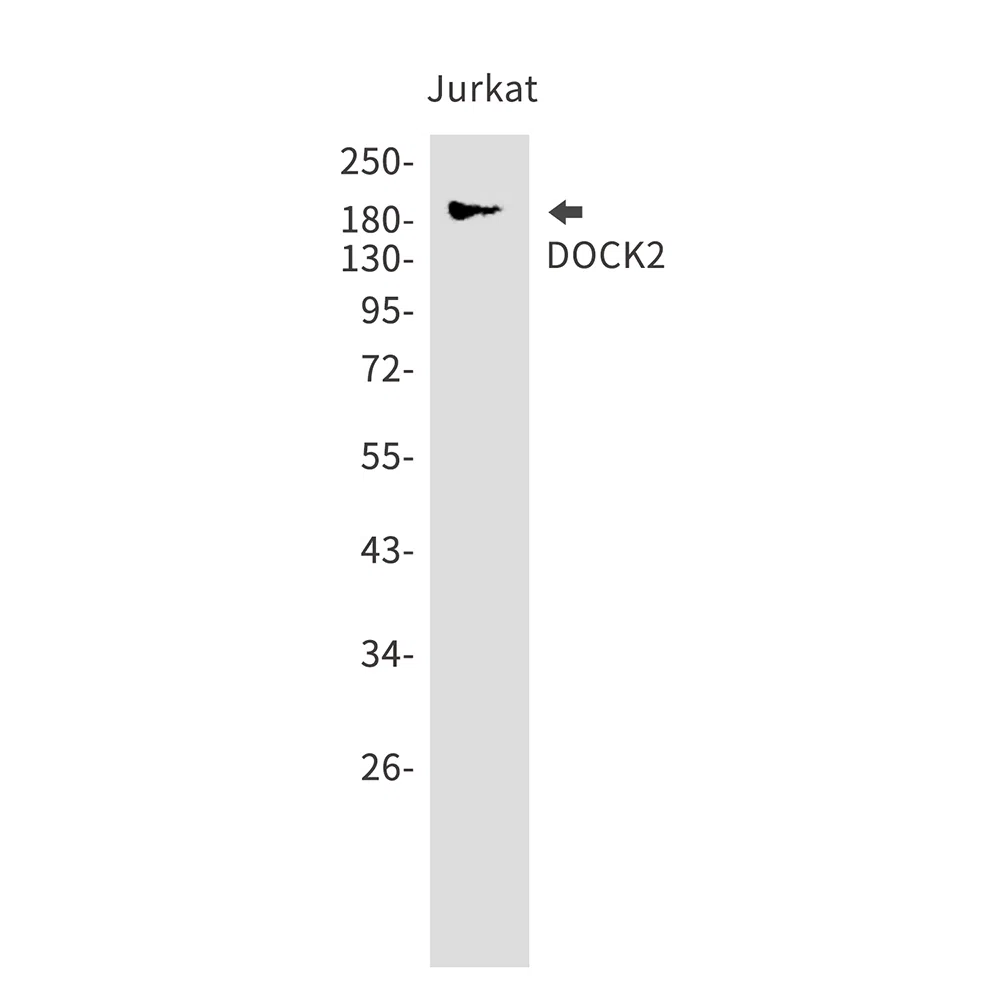 DOCK2 Rabbit Monoclonal Antibody - Size: 100µl