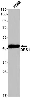DPS1 Rabbit Monoclonal Antibody - Size: 100µl