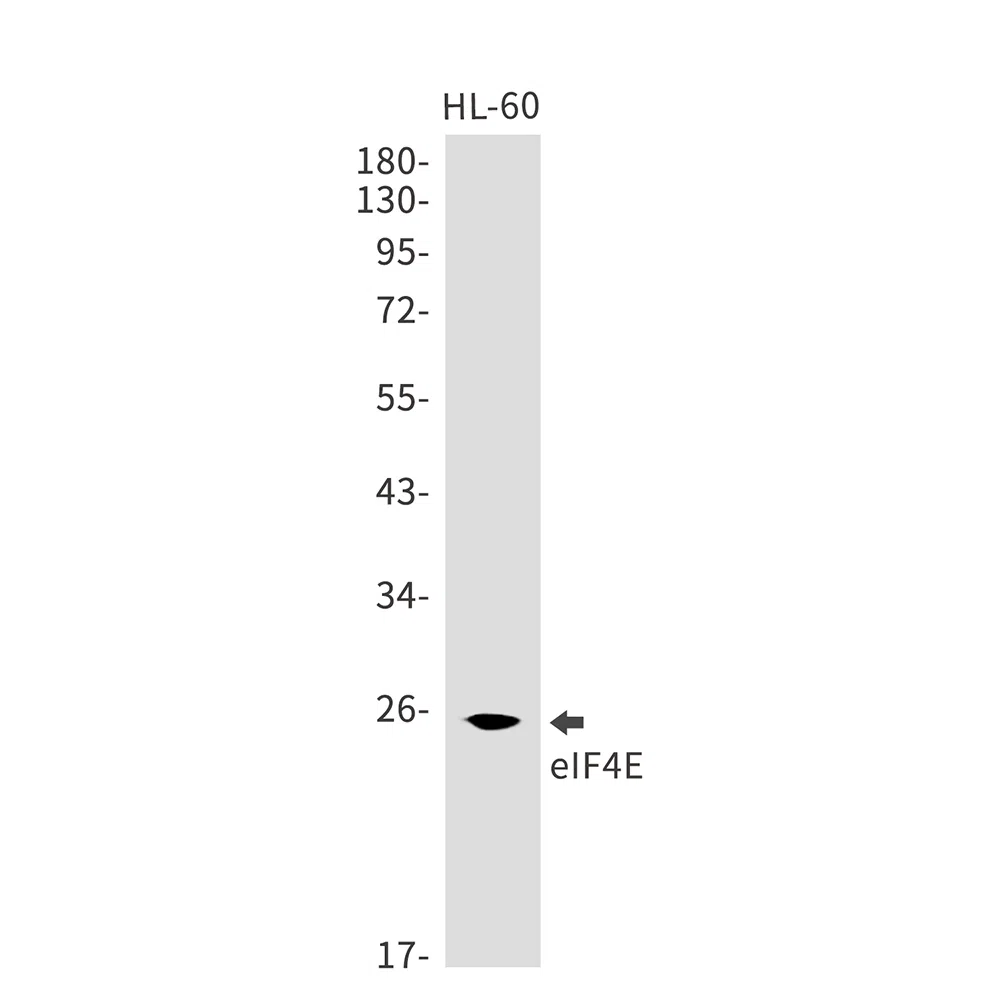 eIF4E Rabbit Monoclonal Antibody - Size: 50µl
