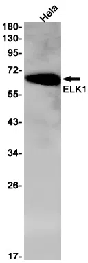 ELK1 Rabbit Monoclonal Antibody - Size: 50µl