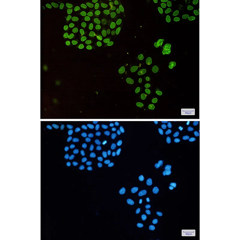 Immunocytochemistry(ICC) - Emerin Rabbit Monoclonal Antibody AMRe85536