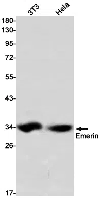 WesternBlot(WB) - Emerin Rabbit Monoclonal Antibody AMRe85536