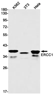 ERCC1 Rabbit Monoclonal Antibody - Size: 50µl
