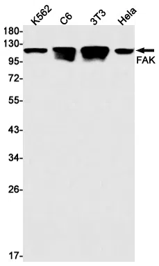 FAK Rabbit Monoclonal Antibody - Size: 50µl