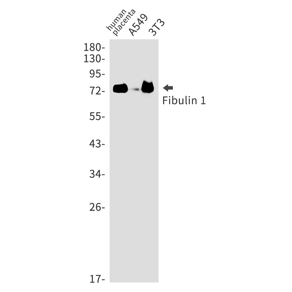 Fibulin 1 Rabbit Monoclonal Antibody - Size: 50µl