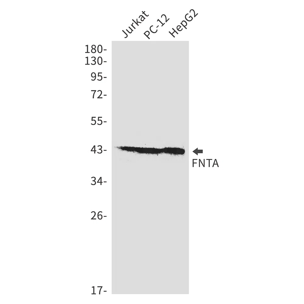 FNTA Rabbit Monoclonal Antibody - Size: 50µl