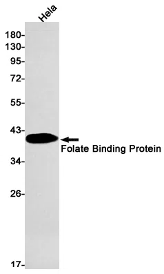 Folate Binding Protein Rabbit Monoclonal Antibody - Size: 50µl
