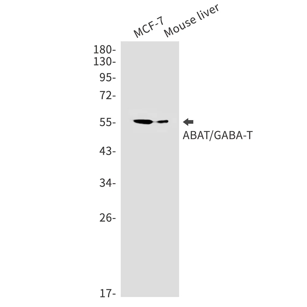 ABAT Rabbit Monoclonal Antibody