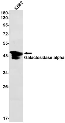 Galactosidase alpha Rabbit Monoclonal Antibody - Size: 50µl