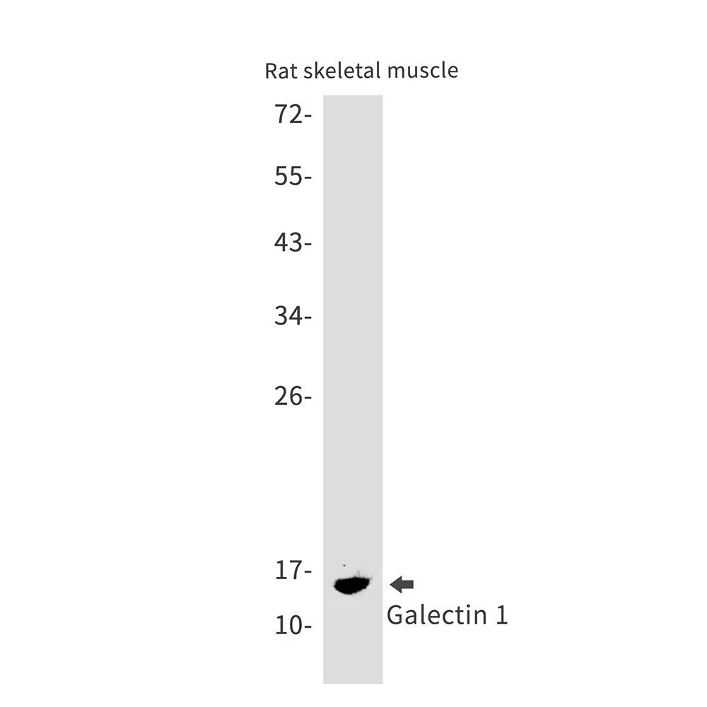 Galectin 1 Rabbit Monoclonal Antibody - Size: 100µl