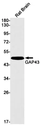GAP43 Rabbit Monoclonal Antibody