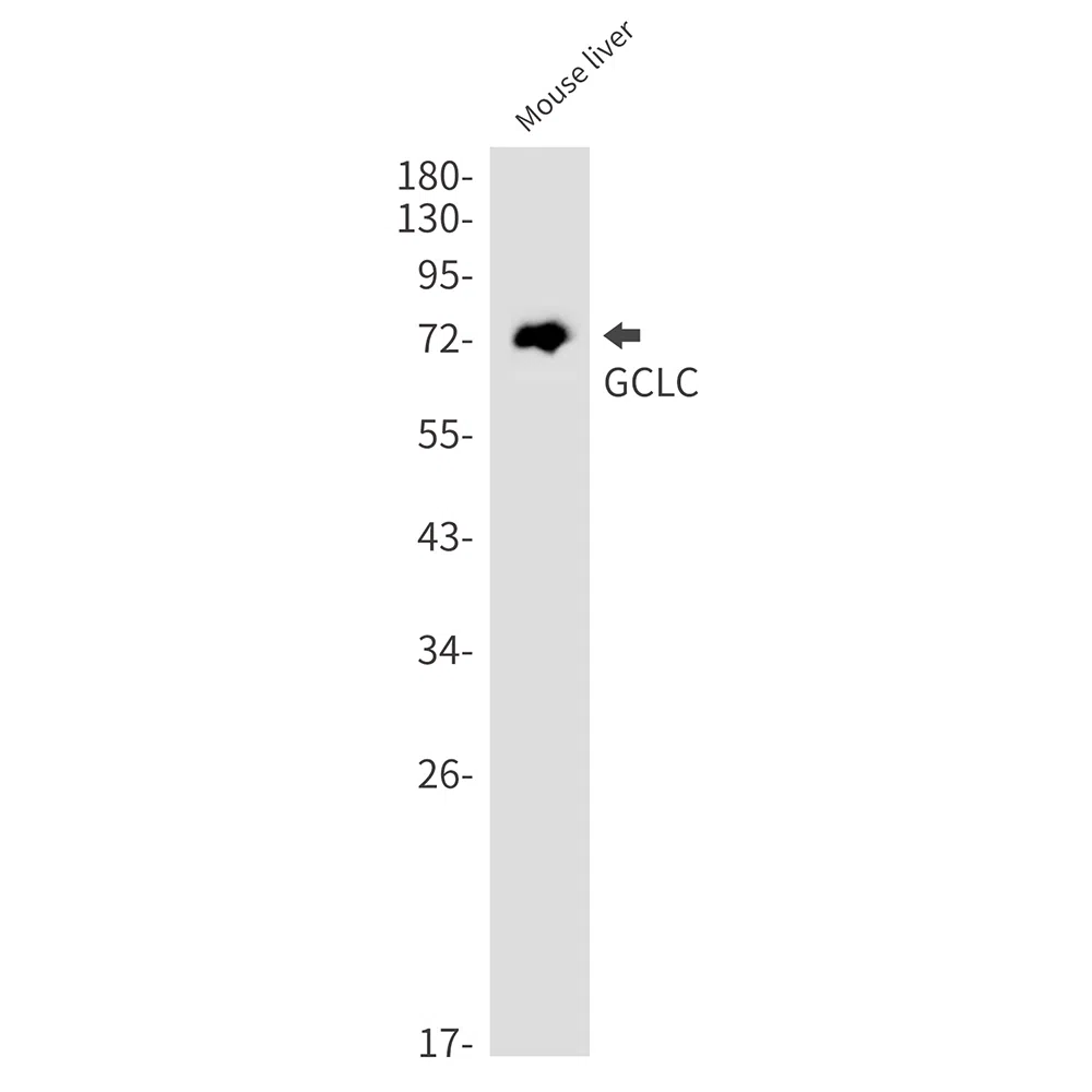 GCLC Rabbit Monoclonal Antibody - Size: 100µl