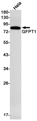 GFPT1 Rabbit Monoclonal Antibody - Size: 100µl