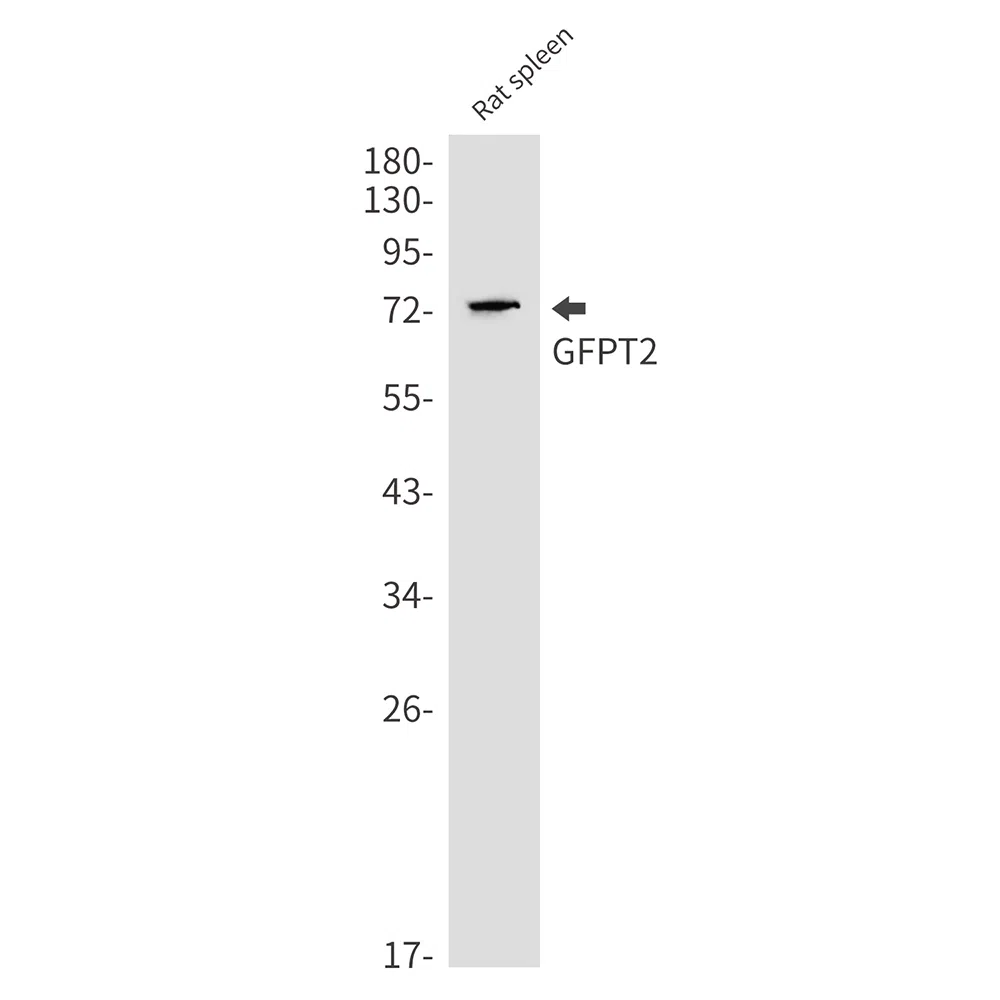 GFPT2 Rabbit Monoclonal Antibody - Size: 100µl