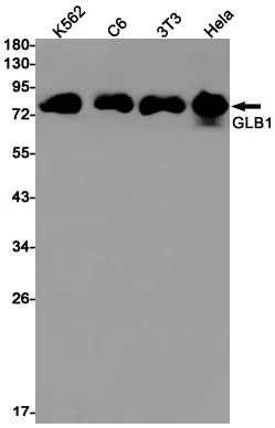 GLB1 Rabbit Monoclonal Antibody - Size: 50µl