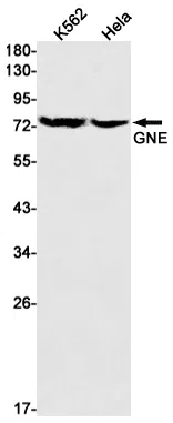 GNE Rabbit Monoclonal Antibody - Size: 100µl