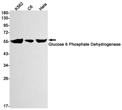 Glucose 6 Phosphate Dehydrogenase Rabbit Monoclonal Antibody - Size: 100