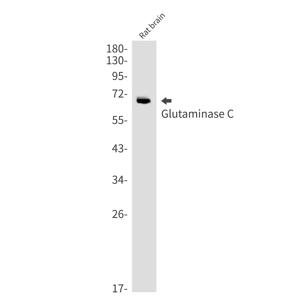 Glutaminase Rabbit Monoclonal Antibody - Size: 100µl