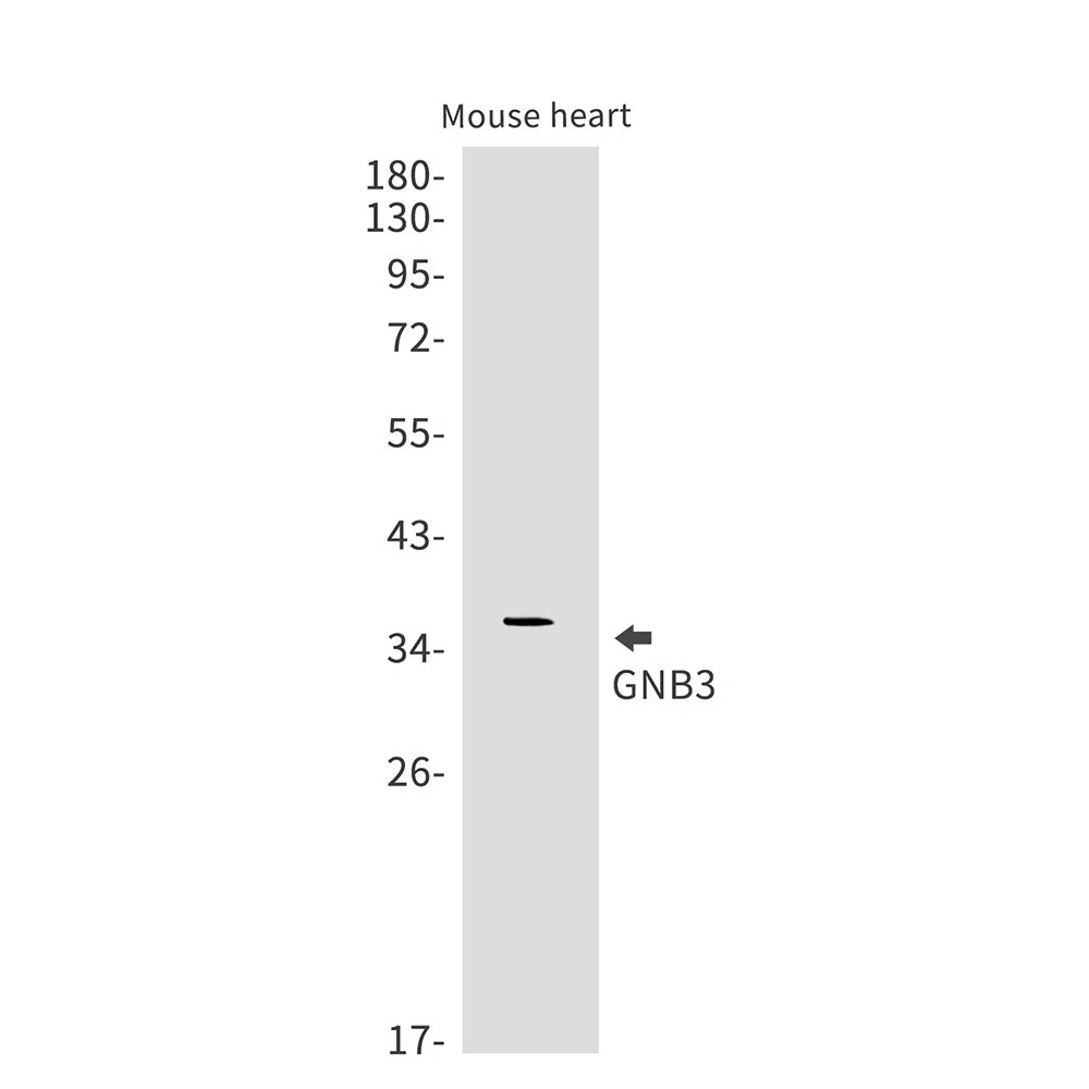 GNB3 Rabbit Monoclonal Antibody - Size: 50µl