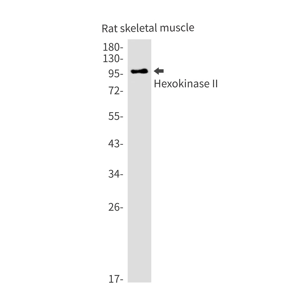 Hexokinase II Rabbit Monoclonal Antibody - Size: 50µl