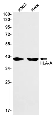 HLA A Rabbit Monoclonal Antibody - Size: 100µl