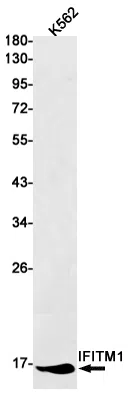 IFITM1 Rabbit Monoclonal Antibody - Size: 50µl