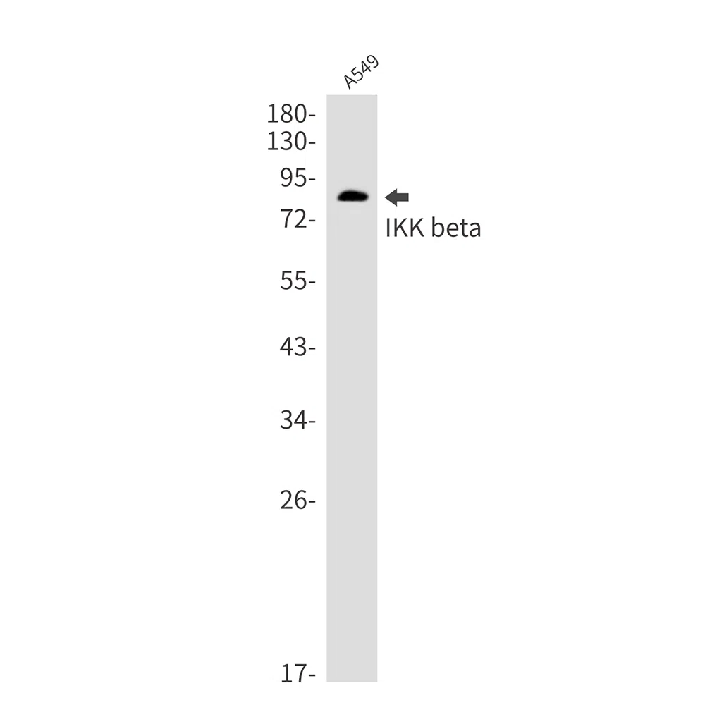IKK beta Rabbit Monoclonal Antibody - Size: 50µl