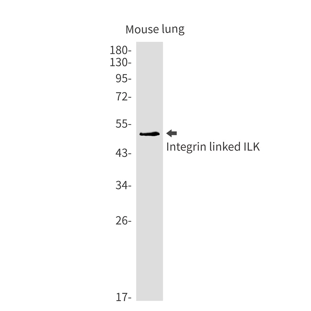 Integrin Linked ILK Rabbit Monoclonal Antibody - Size: 50µl