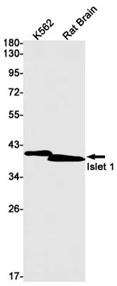 Islet 1 Rabbit Monoclonal Antibody - Size: 100µl