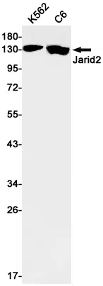 Protein Jumonji Rabbit Monoclonal Antibody - Size: 100µl
