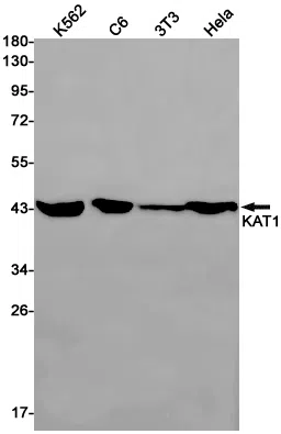 KAT1 Rabbit Monoclonal Antibody - Size: 100µl