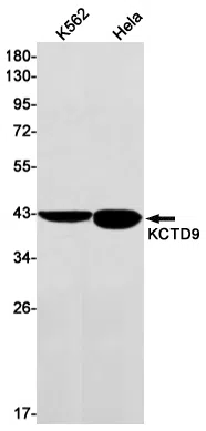 KCTD9 Rabbit Monoclonal Antibody - Size: 50µl