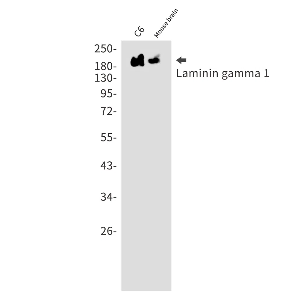 Laminin gamma 1 Rabbit Monoclonal Antibody - Size: 100µl