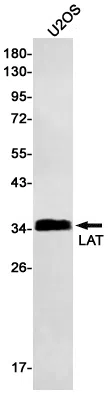 LAT Rabbit Monoclonal Antibody - Size: 100µl