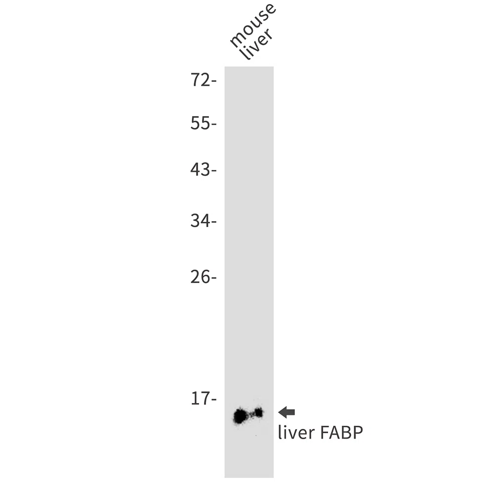 FABP1 Rabbit Monoclonal Antibody - Size: 100µl