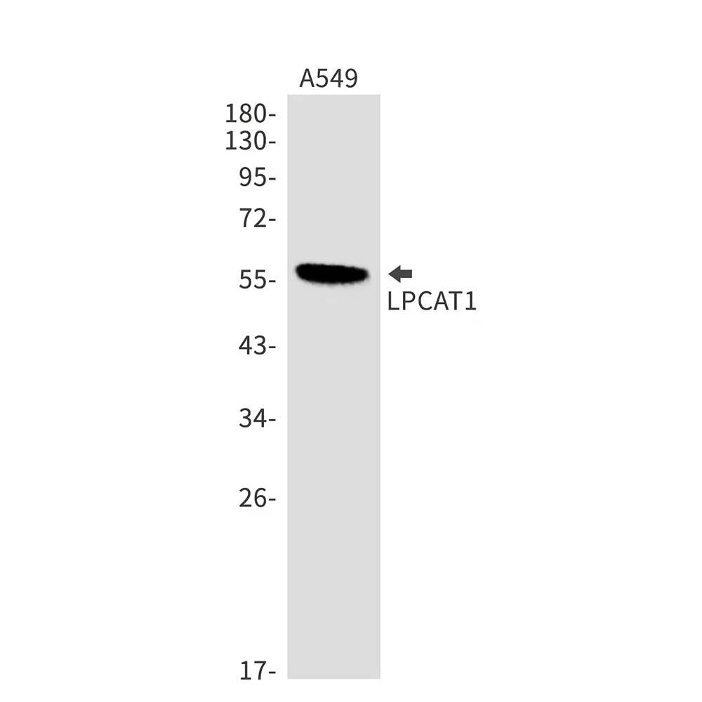 LPCAT1 Rabbit Monoclonal Antibody - Size: 100µl