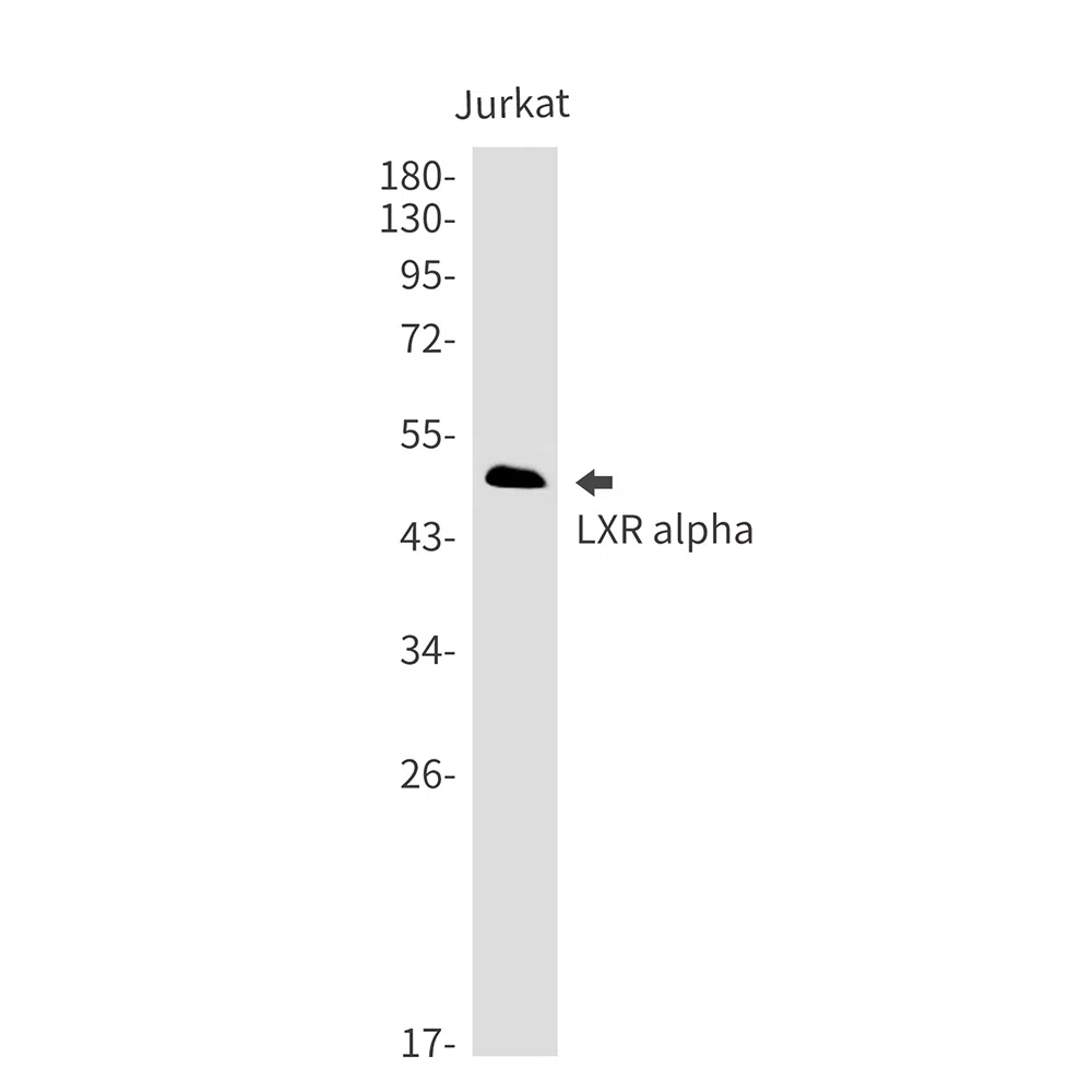LXR alpha Rabbit Monoclonal Antibody - Size: 50µl