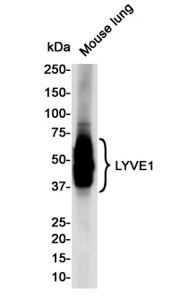 LYVE1 Rabbit Monoclonal Antibody - Size: 50µl