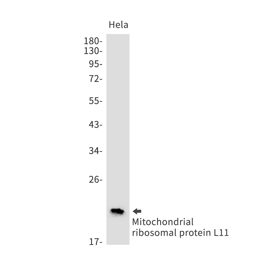 Mitochondrial Ribosomal Protein L11 Rabbit Monoclonal Antibody - Size: 1