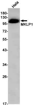 MKLP1 Rabbit Monoclonal Antibody - Size: 100µl