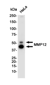 MMP12 Rabbit Monoclonal Antibody - Size: 100µl
