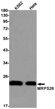 MRPS26 Rabbit Monoclonal Antibody - Size: 100µl