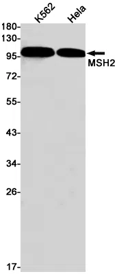 MSH2 Rabbit Monoclonal Antibody - Size: 100µl