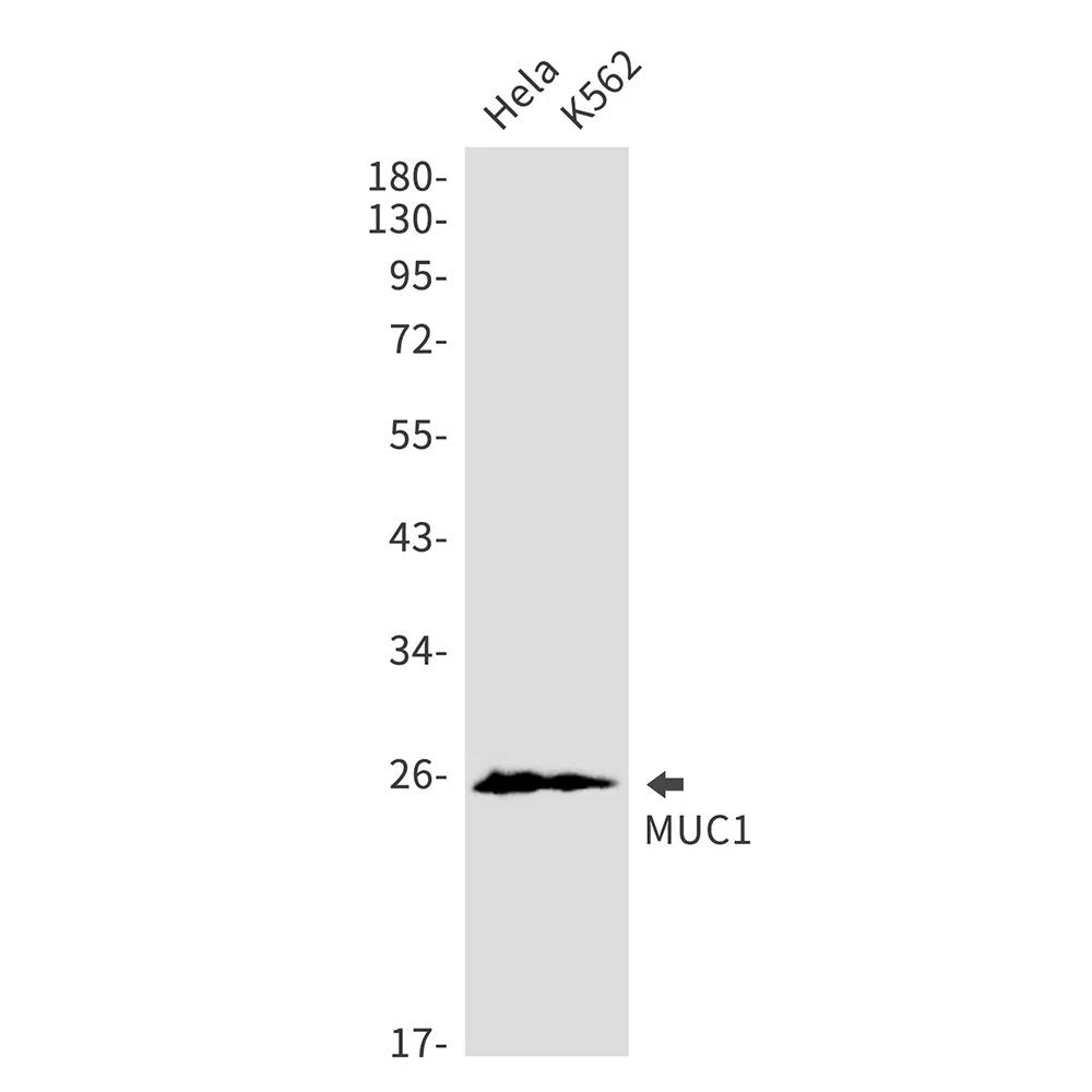 Mucin 1 Rabbit Monoclonal Antibody - Size: 100µl