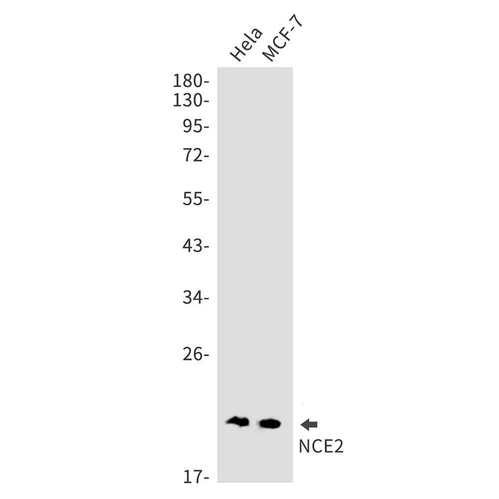 NCE2 Rabbit Monoclonal Antibody - Size: 100µl