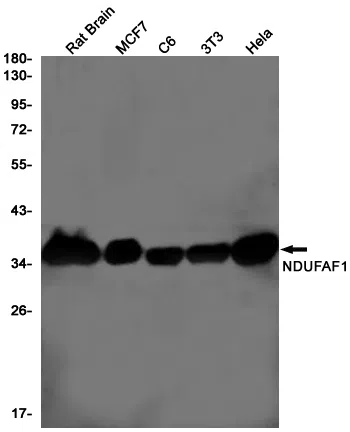 NDUFAF1 Rabbit Monoclonal Antibody - Size: 100µl