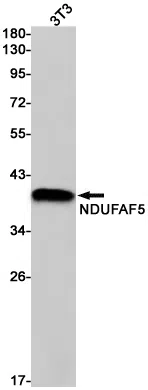 NDUFAF5 Rabbit Monoclonal Antibody - Size: 100µl